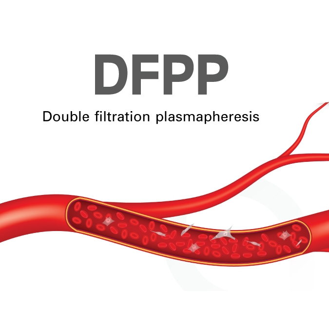 BBH Double Filtration Plasmapheresis (DFPP)