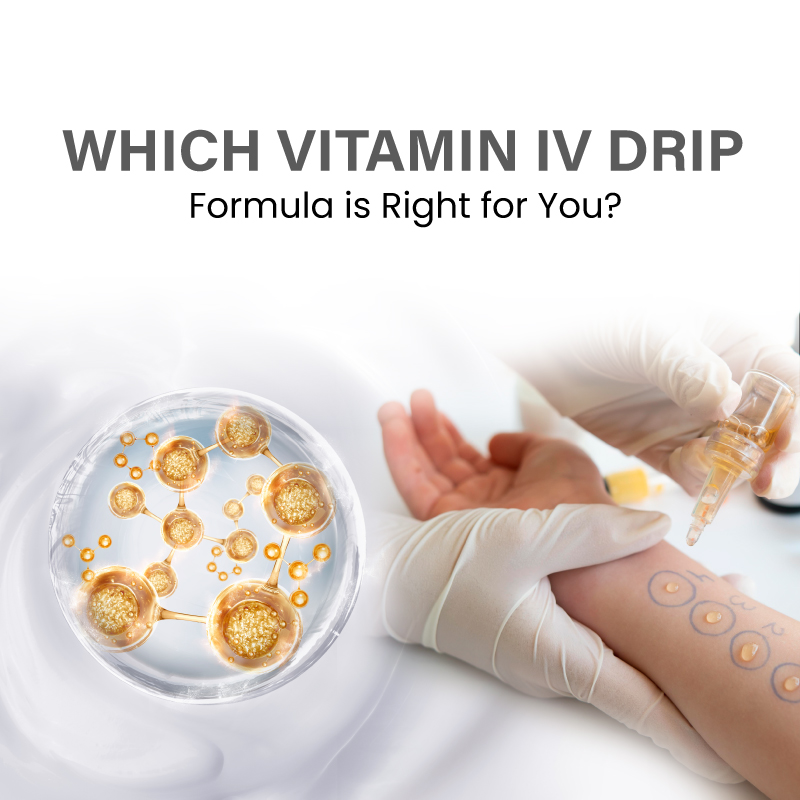 Which Vitamin IV Drip Formula is Right for You?