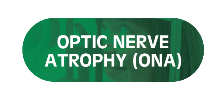 Optic Nerve Atrophy (ONA)