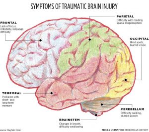 Traumatic Brain Injury : BBH Hospital : Functional Medicine : Better ...