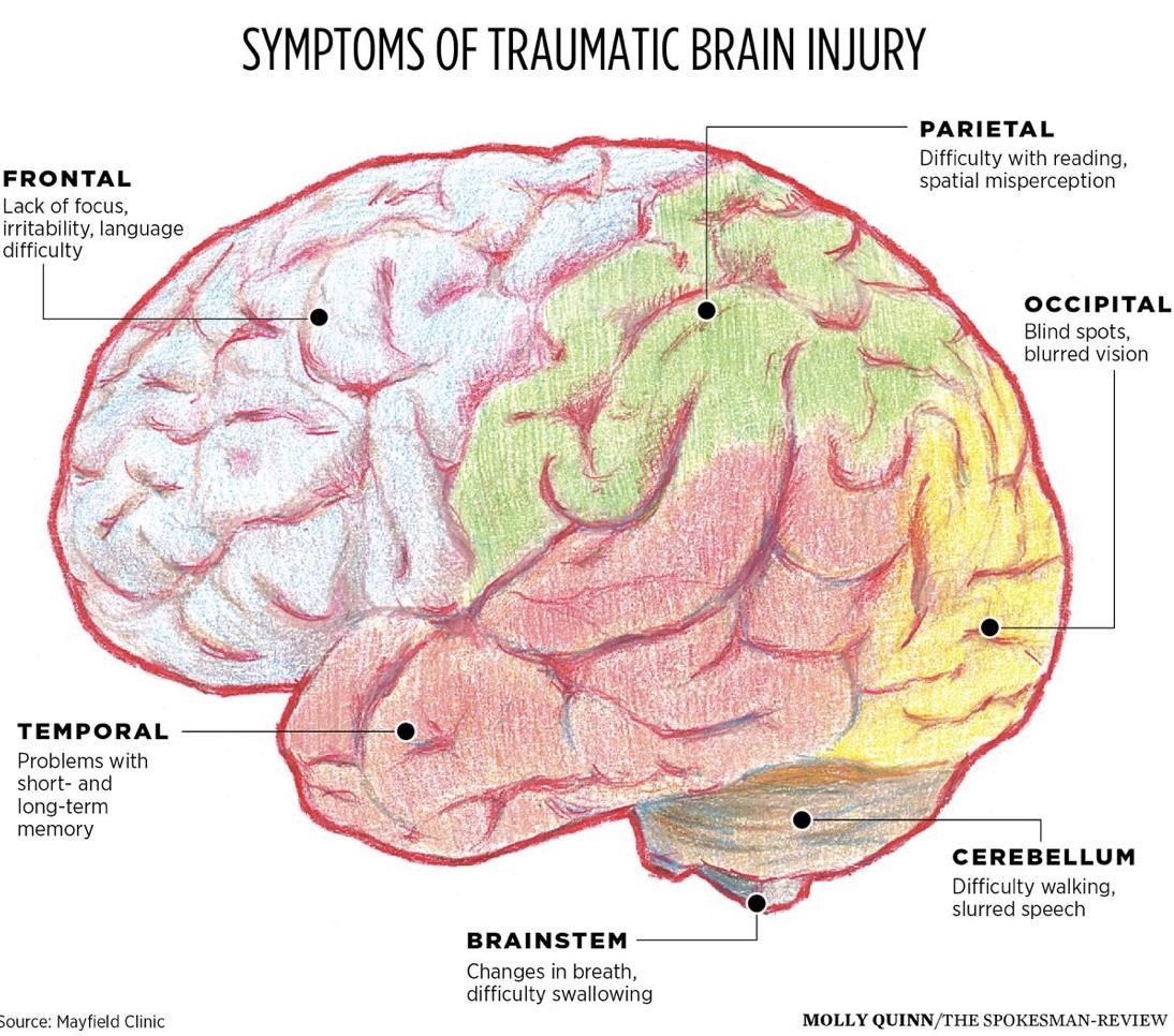 Traumatic Brain Injury BBH Hospital Functional Medicine Better traumatic-brain-injury-bbh-hospital-functional-medicine-better